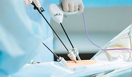 Advanced Gynae Procedures