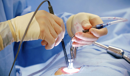 Microscopic / Endoscopic Surgery