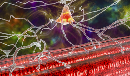 Neuromuscular Disorders